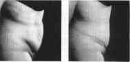 abdomen2.jpg